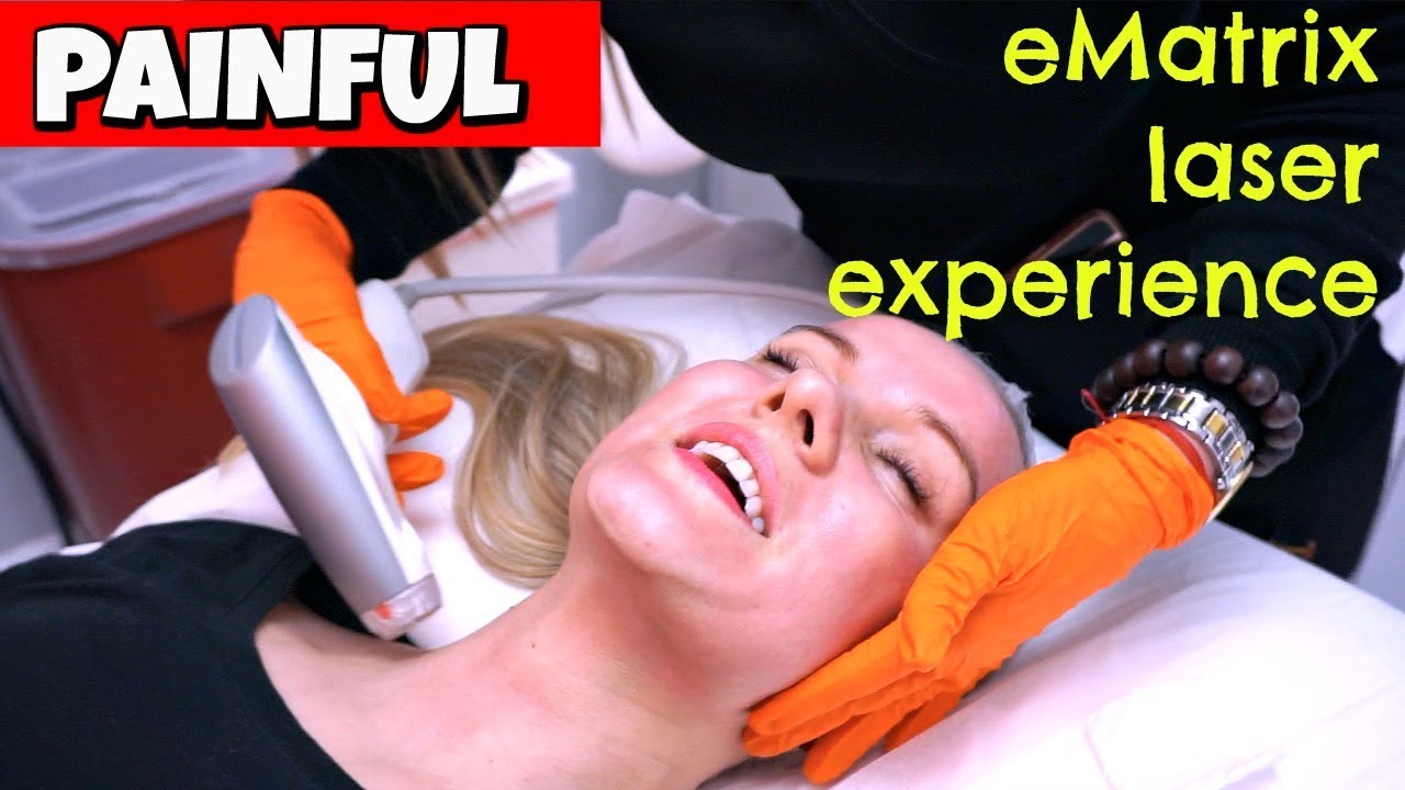 Ematrix Laser Experience Youtube