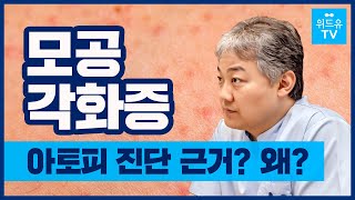 오톨도톨 닭살 피부 관리, 좁쌀여드름? 모공각화증이 아토피 진단의 근거가 될 수 있다?!