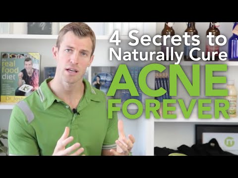 4 Secrets to Get Rid of Acne Naturally 4 Secrets to Get Rid of Acne Naturally