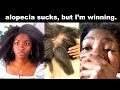 How I beat alopecia | 4C Natural Hair