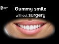 Can you reduce a gummy smile without doing a surgical procedure?- Dr.Ranjani Rao