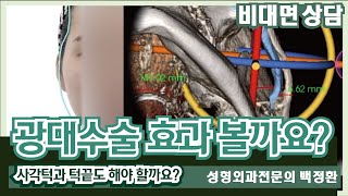 (SUB) 광대수술 효과 볼까요? 광대뼈 L자 절골이 뭔가요?  [비대면상담 #116] / Shall we see the effects of cheekbone surgery?