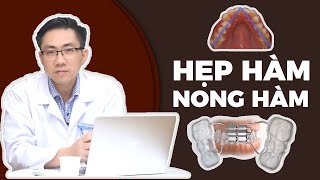 Khi Nào Thì Nong Hàm? Những Trường Hợp Phải Nong Hàm