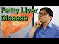 How to Reverse Fatty Liver Disease Naturally | Jason Fung