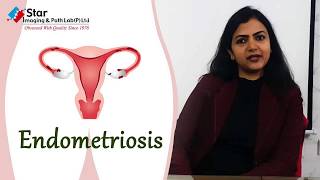 Endometriosis: Symptoms, Causes \u0026 Treatment | Dr. Rani Gupta | Star Imaging \u0026 Path Lab