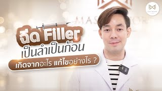 ฉีดฟิลเลอร์เป็นลำเป็นก้อนเกิดจากอะไร?  หมอไอซ์มีคำตอบ