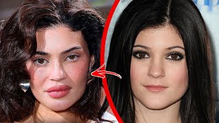10 Celebrities Who Destroyed Their Face Beyond Recognition