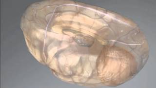 Surgical stentrode could revolutionise thought control tech 07 March 2016