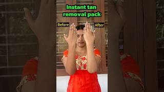 എത്ര വർഷത്തെ tan remove ചെയ്യാം💯#detanning #tanning #tanremoving #tanremoving #skinwhitening#suntan