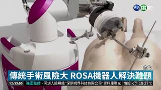 全台唯一ROSA機器人 助脊椎手術更精準 | 華視新聞 20190218