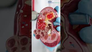 Difference between a Nephrologist and a Urologist |  Dr. Topoti Mukherjee | Aster Whitefield