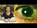 healing galing s16ep12 eye special episode part3