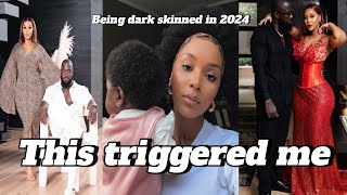 The challenges that come with being dark - skinned in 2024!