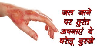 जल जाने पर तुरंत अपनाएं ये घरेलू नुस्खे | Learn with Speaking Tree