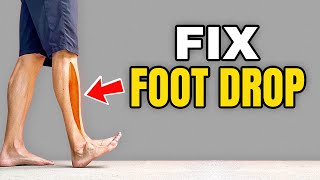 3 Exercises to Correct Foot Drop