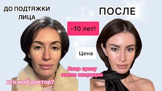 Увеличение груди БЕЗ имплантов!? Подтяжка лица. Восстановление после операции. Сколько стоит?