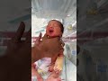 Hungry bird in nicu #nicu #babybird #cutebabies #bornebaby #babycare #newbornbaby # shorts #viral