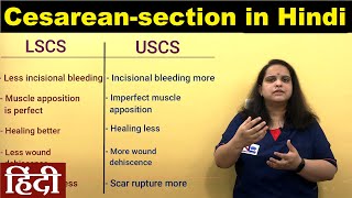 Cesarean delivery in Hindi [ C-Section ] Nursing Lecture