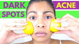 HOW TO APPLY LEMON ON FACE / Rubbing lemon on face