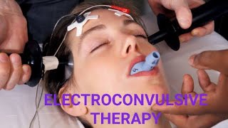 Electroconvulsive therapy (ECT)for Nursing students,AIIMS, Railway,DSSB,ESIC Exams
