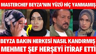 Masterchef Beyza'nın Yüzü Yanmamış Herşey Yalanmış Mehmet Şef Somer Sivrioğlu GERÇEKLER ŞOKE ETTİ