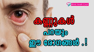 കണ്ണ് നോക്കി രോഗങ്ങൾ തിരിച്ചറിയാം | Eye disease | Ethnic Health Court