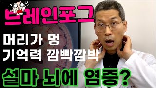 머리가 멍, 기억력 사라질때...#코로나후유증, 설마 젊은치매? 브레인포그? #치매전조증상 I #루이빈치과 류지헌 원장