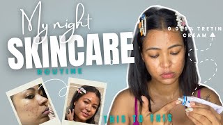 My Updated Night Skincare 2025 | How i Use Tretinoin Step-by-Step | Acne Transformation in 4 Months✨