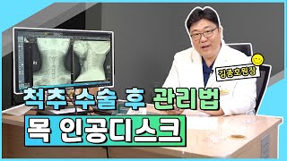 Dr.김종호의 목 인공디스크 수술 후 관리법