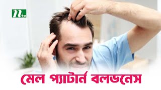 মাথায় টাক পড়া বংশগত কিনা । Shastho Protidin | স্বাস্থ্য প্রতিদিন |