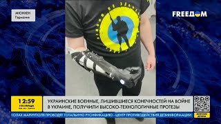 Как украинским военным заменяют потерянные конечности