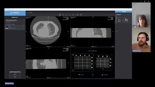 WEBINAR. MedDream Integration Case Study: Medical Templates