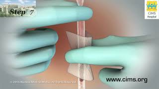 Drainage Tube Care (Gujarati) – CIMS Hospital