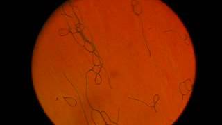 Electroinduced instability in cholesteric LC