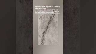 🐜எறும்புகளின் சமூகக் கட்டமைப்பு எப்படிப்பட்டது?😱ராணி கைப்பற்றப்பட்டால்...#shorts #trending #muthu