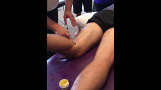IASTM technique for the hamstrings with OMT Training www.omttraining.co.uk