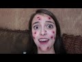 Kaelyn Has A VERY Weird Illness!