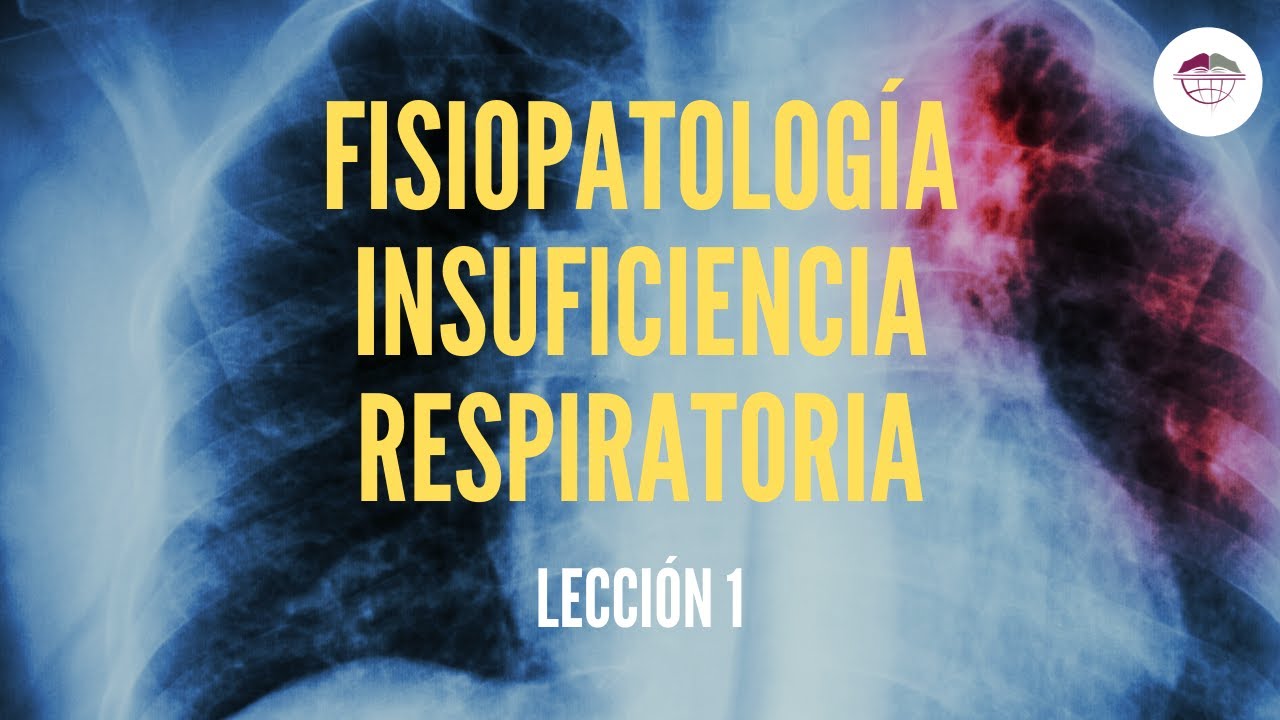 1. FISIOPATOLOGÍA DE LA INSUFICIENCIA RESPIRATORIA (FISIOPATOLOGÍA ...