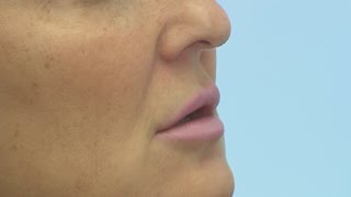 Avoiding face wrinkles