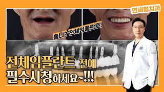 [전체임플란트] 전체임플란트 잘 모르시겠다면 꼭 시청하세요!!! | 전체 임플란트 개수 | 전체 임플란트 과정 | 전체 임플란트 대상 | 전체 임플란트 부작용 | 연세힐치과