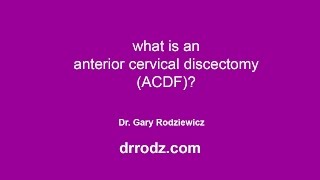 What is an ACDF?