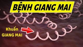 Hiểu rõ về bệnh Giang Mai trong 5 phút