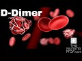 What the D Dimer test tells you.