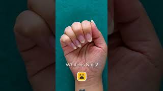 How to whiten your nails #shorts