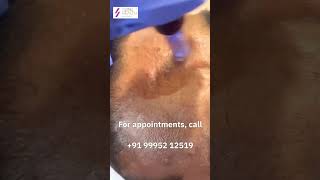 Vampire Facials | Skin PRP + Microneedling | Dr Shruthi Vijayan | Skinn Health