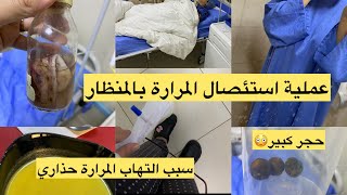 تجربتي مع عملية إستئصال المرارة بالمنظار 🩻 رجيم حاد 😳تخدير عام 😷 شحال المبلغ ✅