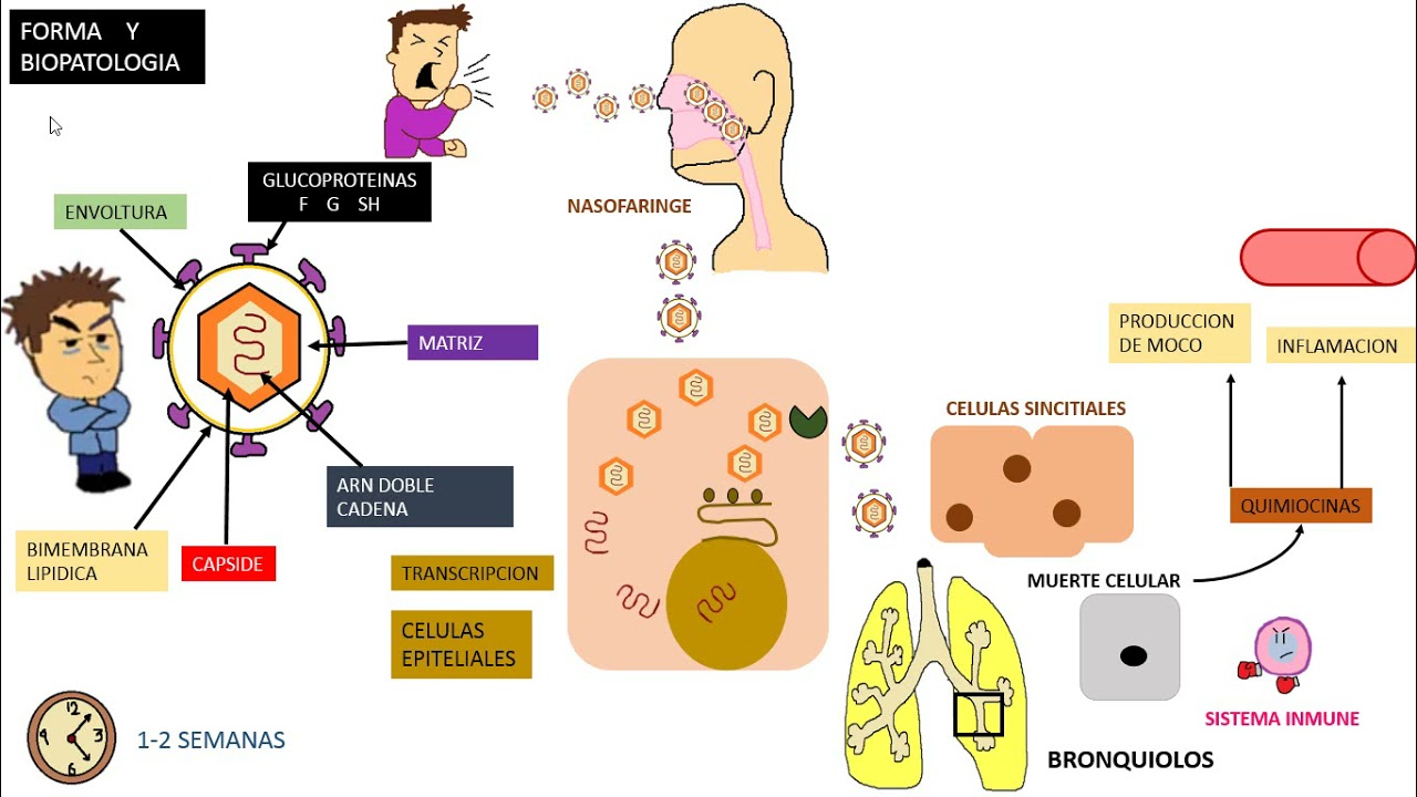 Virus Sincitial Respiratorio VSR - YouTube