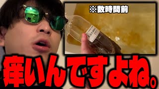 【悲報】おにや、身体が痒い【o-228 おにや/ﾏﾀｰﾘ雑談】