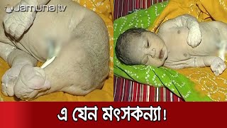 বগুড়ায় মৎসকন্যা আকৃতির শিশুর জন্ম! | Miracle Baby | Mermaid!