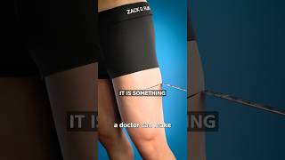 The Surgery To Become Taller 😨 Surgeon Reacts